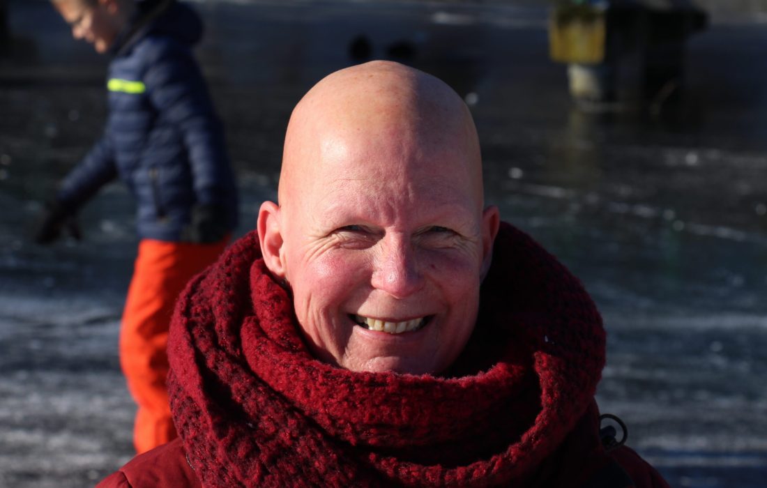 alopecia Je eigen plek innemen Caroline Pinter Wandelcoach Haarlemmermeer